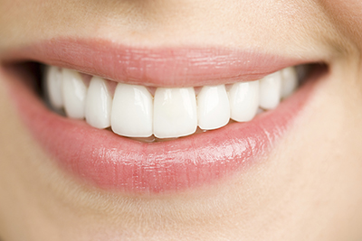 Close up of woman smiling after getting her teeth cleaned in Upland CA