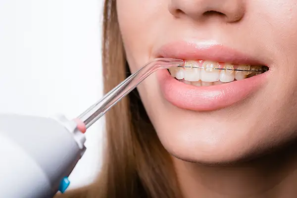 A woman using a water flosser to clean around her braces, demonstrating an effective oral hygiene tool for orthodontic care.